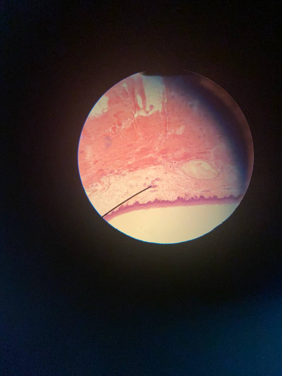 term image