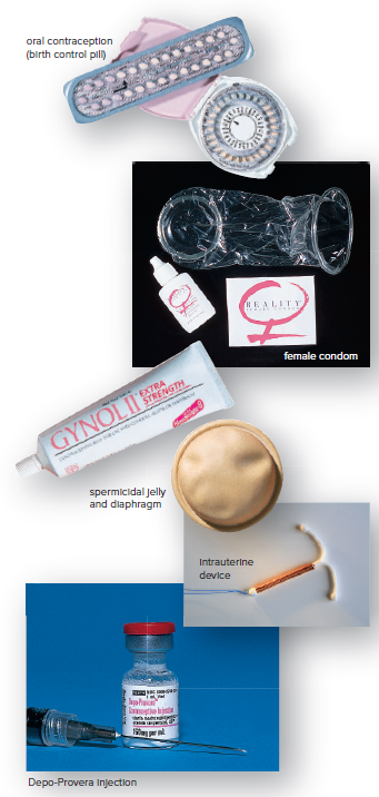 Contraceptive devices.
