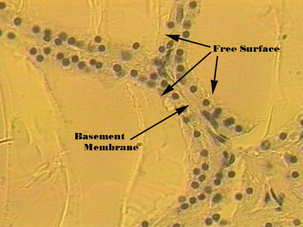 <p><span style="color: rgb(0, 0, 0)">Delicate, thin: inner lining of lung alveoli</span></p>