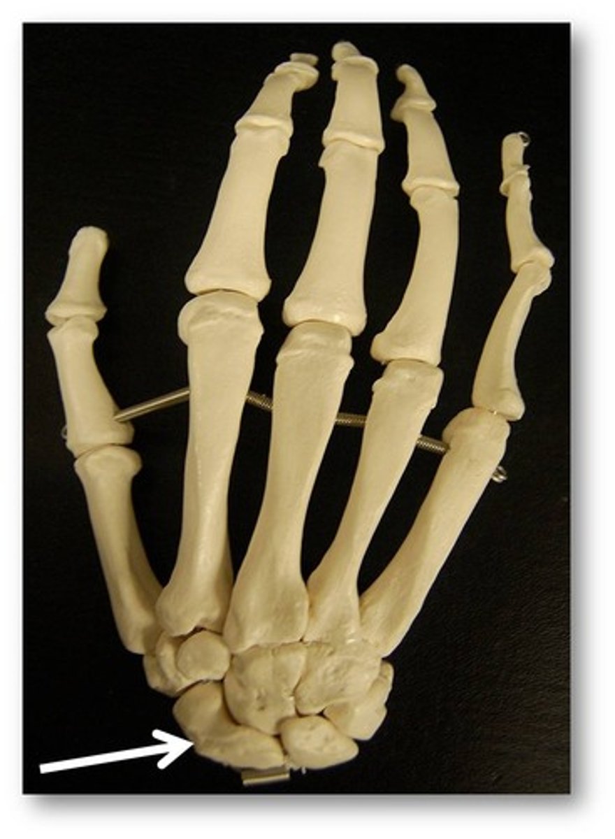 <p>Name this specific bone of the hand (posterior view).</p>