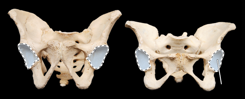 <p>Name the highlighted portion.</p><p>(Pelvis, anterior view).</p>