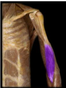 <p>Name this muscle and it’s action </p>