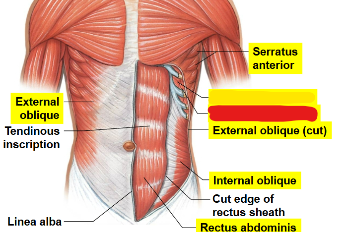 <p>What muscle is this?</p>