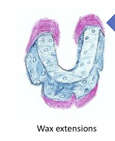 <p>Describe why wax is added in these areas of a lower impression tray?</p>