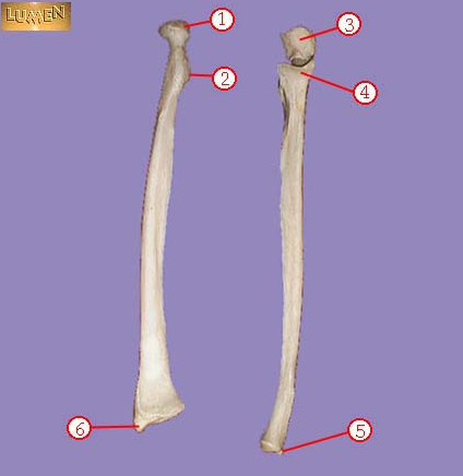 <p><span>Identify bone marking number 3.&nbsp; Scooping in region.</span></p>