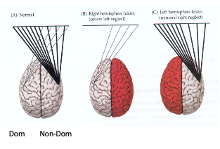 <p>both (more stongly on the left)</p>