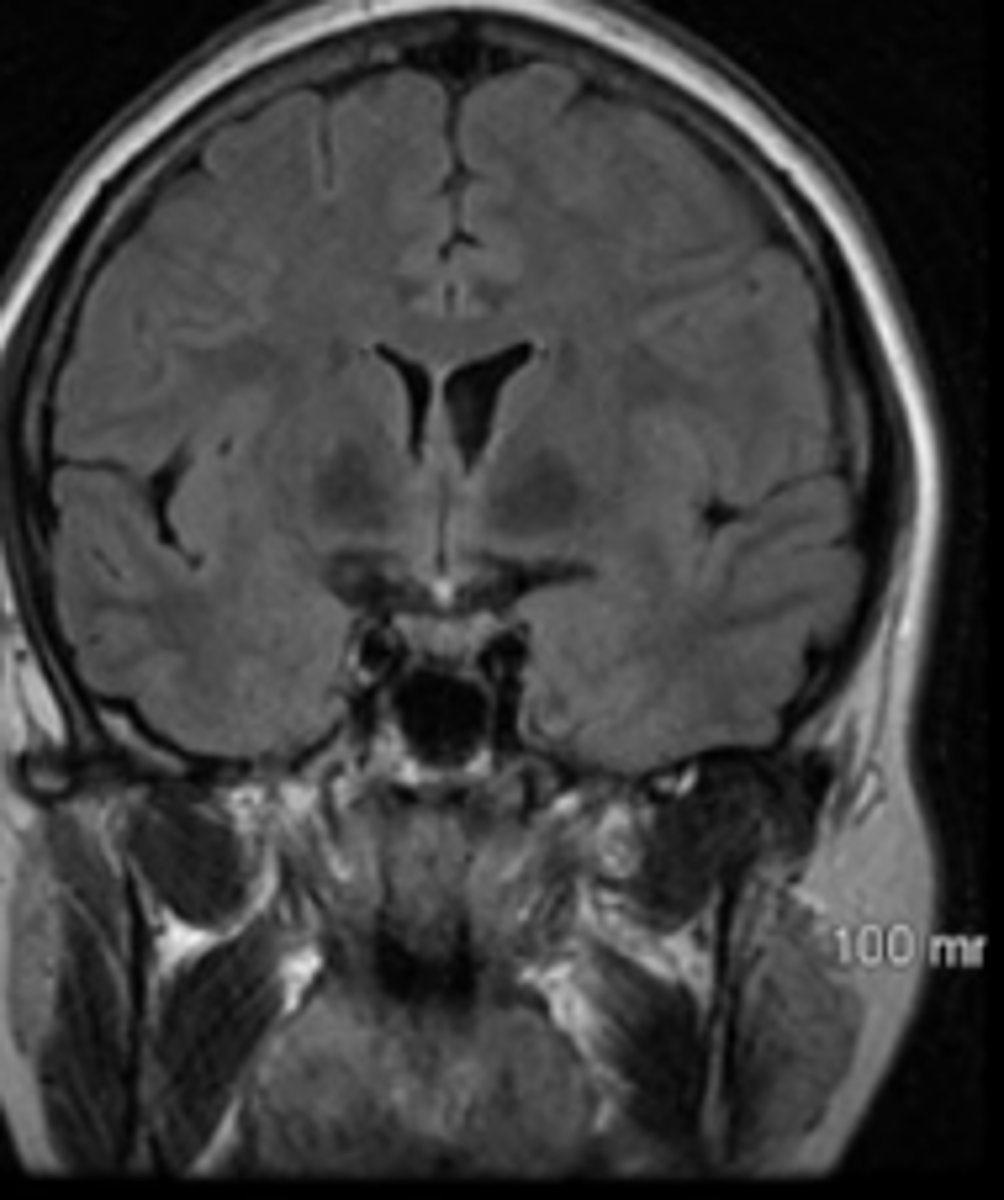 <p>imaging plane that is along the vertical plane, separating the body from front to back</p>