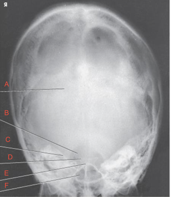 <p>what is B pointing to? </p>