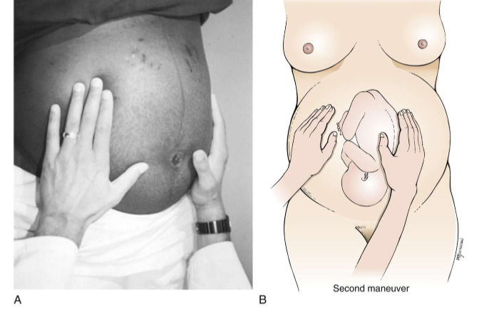 <ul><li><p>abdomen </p></li></ul><p></p>