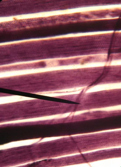 <p>What is the pointer on?</p>