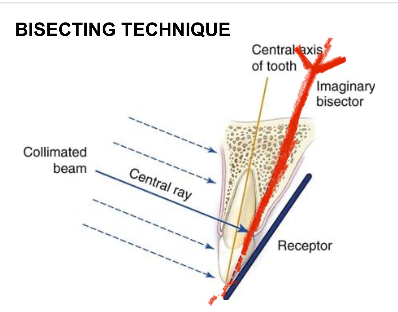 <p><span>90° angle (straight) to the imaginary bisecting line between the tooth’s long axis and the receptor.</span></p><p></p>