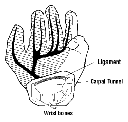 <ul><li><p><span>condition affecting the hand and wrist</span></p></li><li><p><span>Any action that squeezes or irritates the median nerve may cause</span></p></li></ul><p></p>
