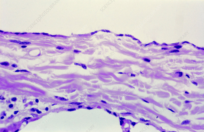 <p>Name this tissue </p>