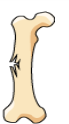 <p>Type of fracture? </p>