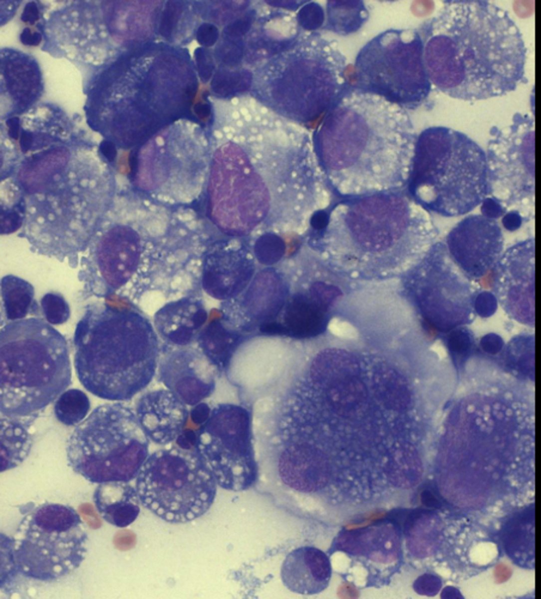 <p>What type of round cell tumor is this?</p>
