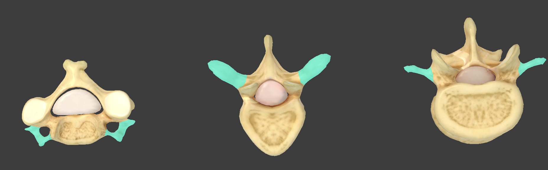 <p>what component of vertebrae is this?</p>