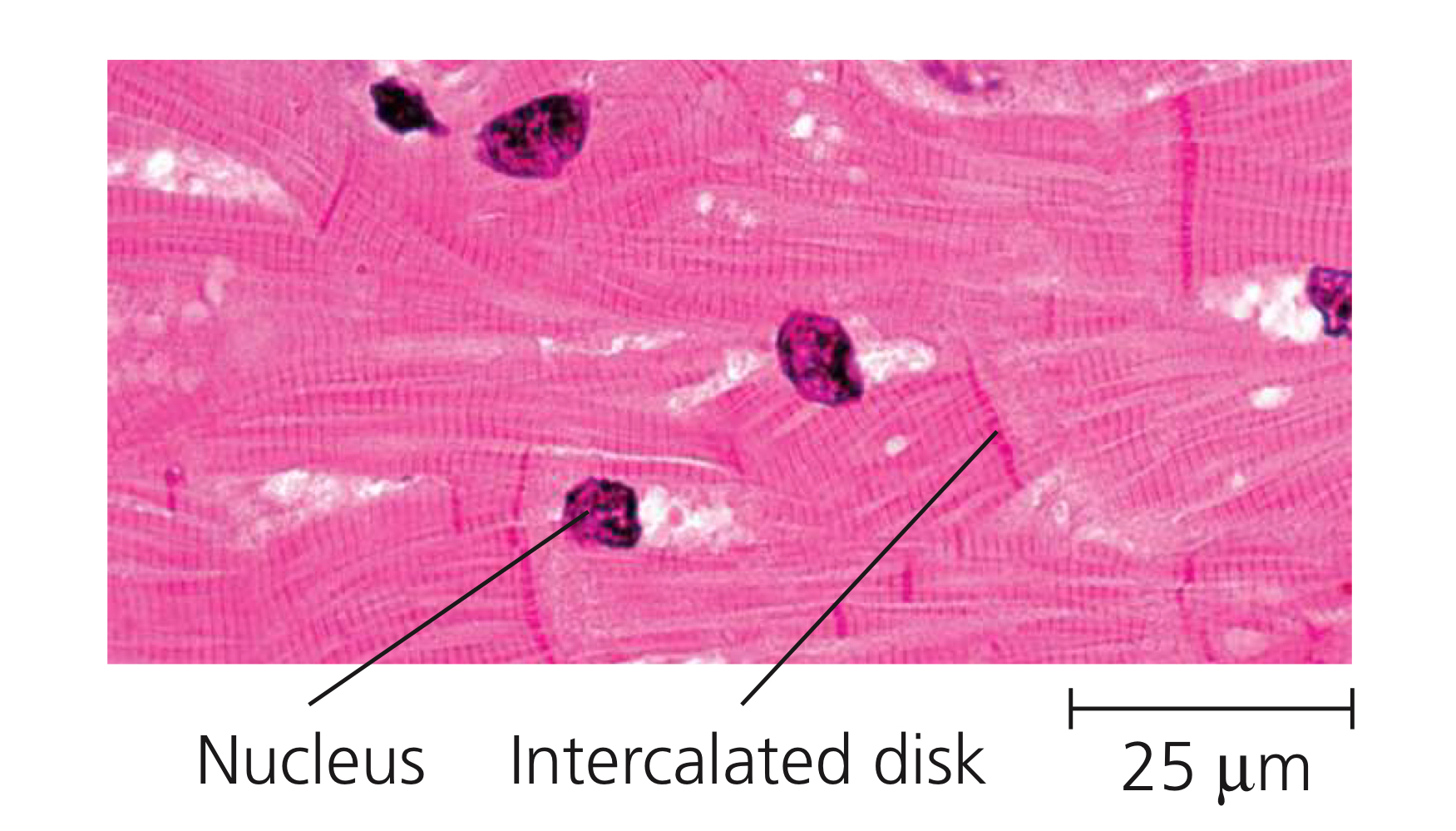 <p>Only in vertebrates, muscle composed of muscle fibres interconnected via intercalated disks, responsible for being the heart contractile wall, contracting the heart.</p><p><em>A good indicator is the branched fibre appearance.</em></p>