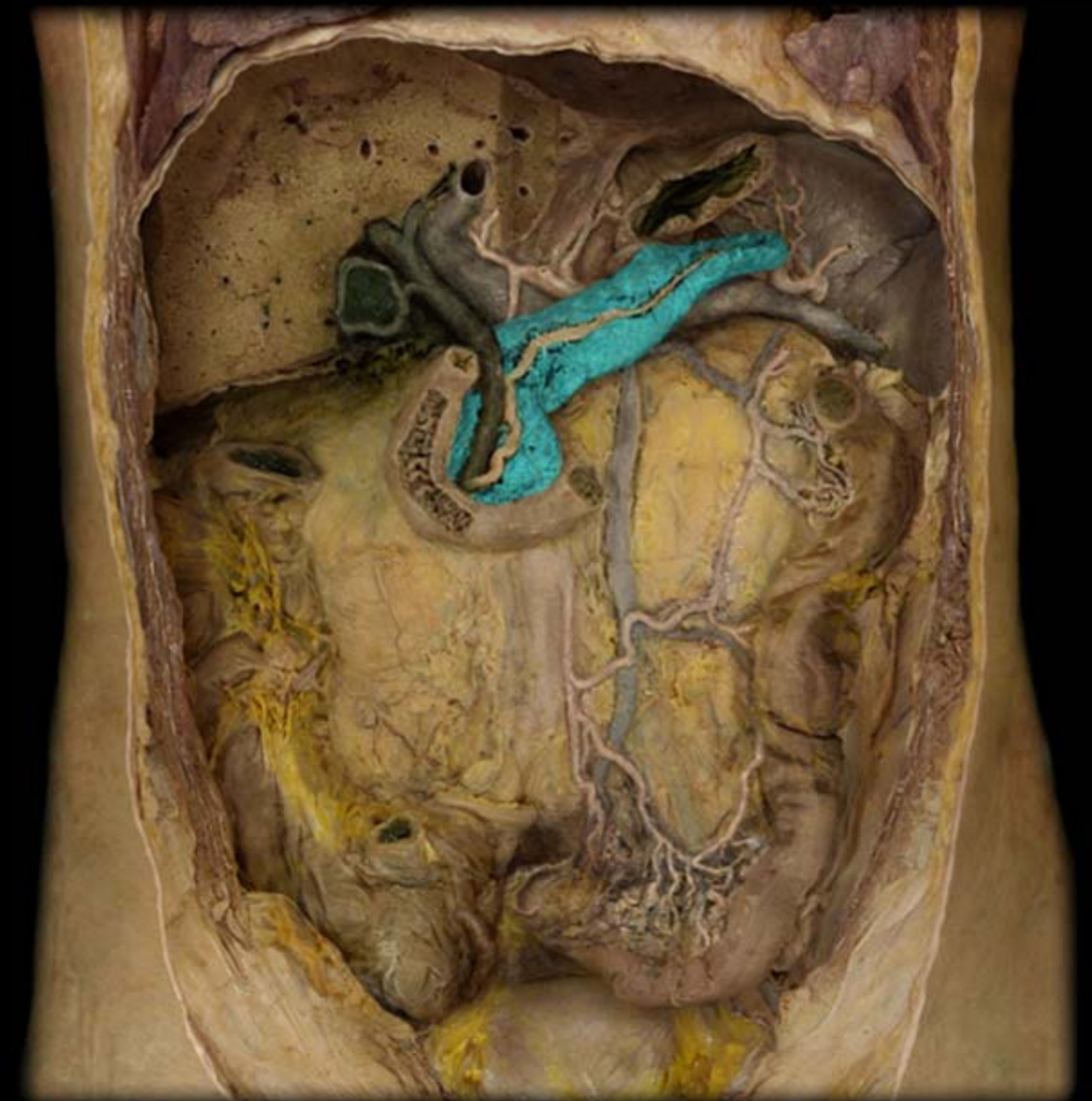 <p>What is this </p>