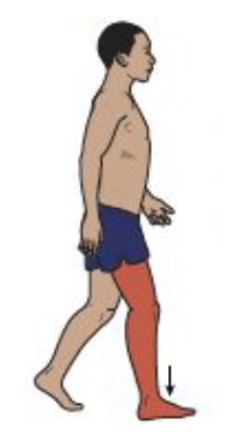 <ul><li><p>Loading Response</p></li><li><p>Ankle motion</p></li><li><p>Pre-tibial muscles decelerate forefoot lowering and draw the tibia forward following initial contact</p></li></ul><p></p>