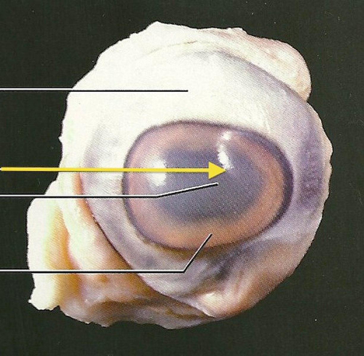 <p>clear "disk" covering the iris and pupil</p>