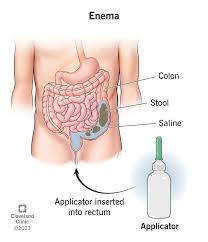 <p>What should the nursing assistant do if a resident is complaining of pain during an enema?</p>