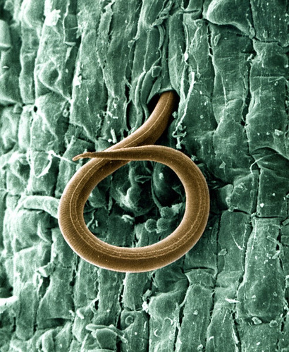 <p>Guinea worm, Elephantiasis, Pinworm, Heartworm, trichinosis, River blindness</p>