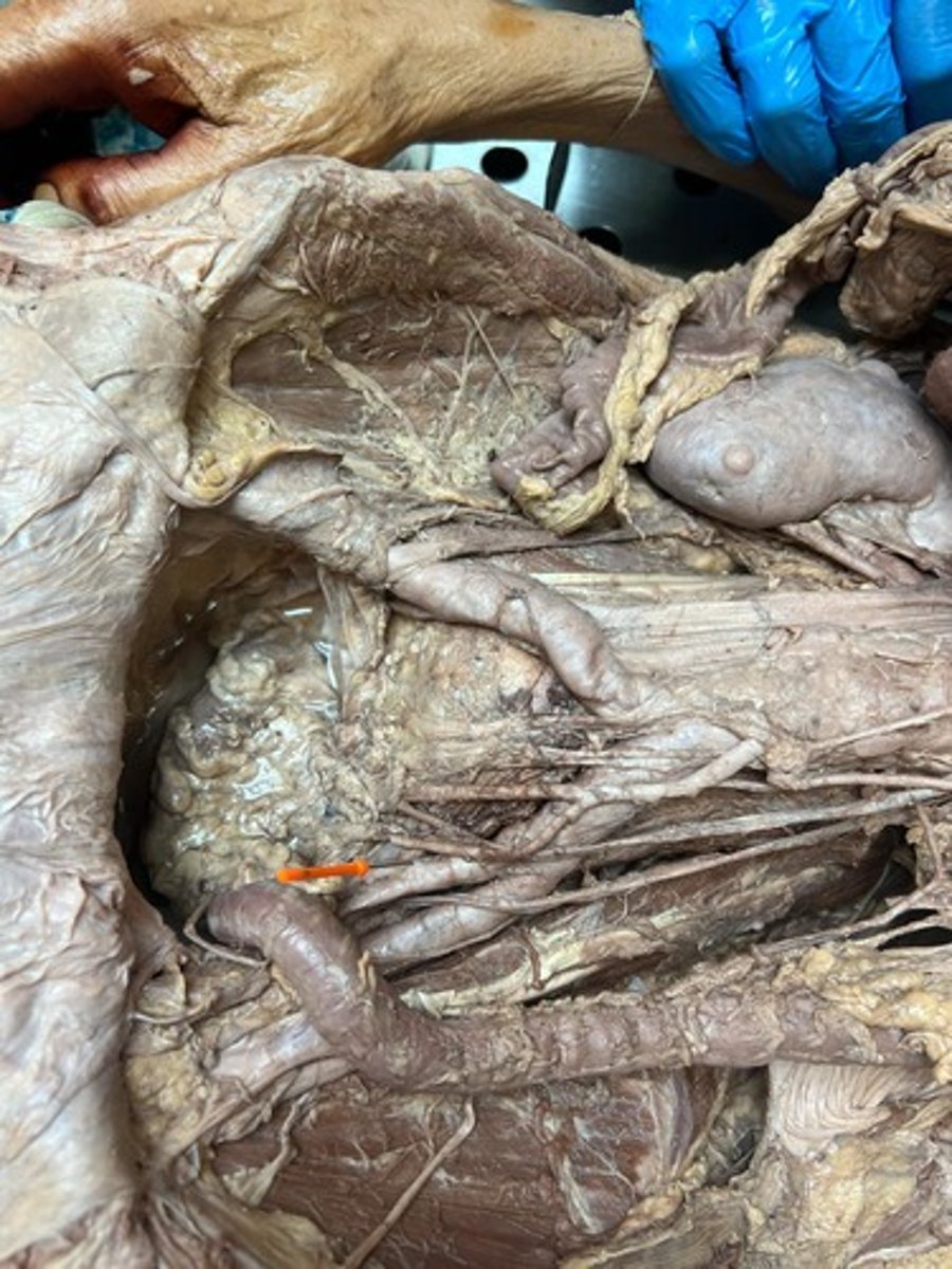 <p>internal iliac artery</p>