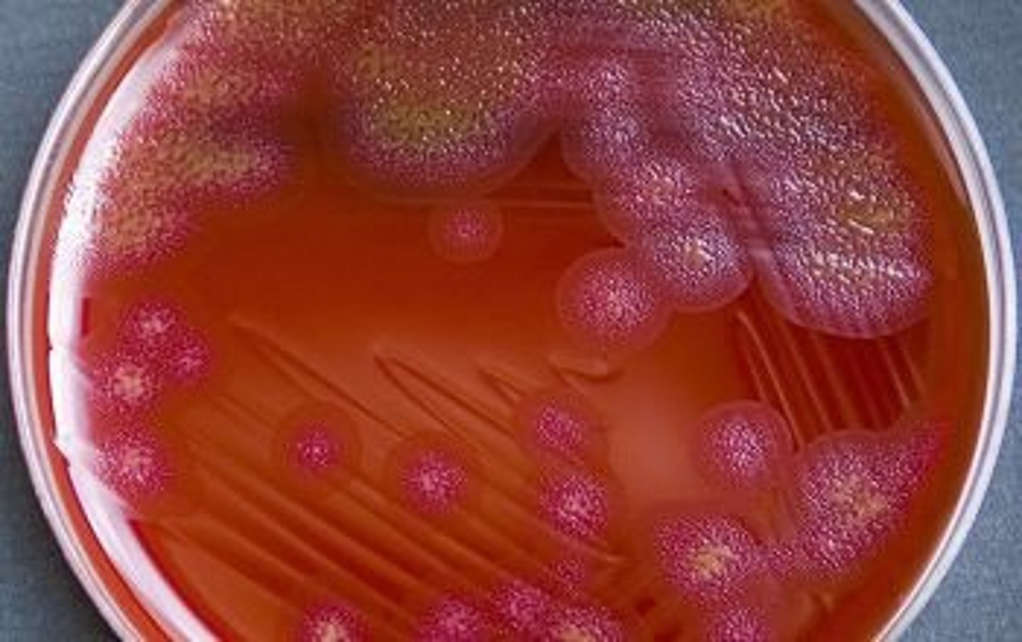 <p>Gram negative bacilli.</p><p>In the Flavobacteriaceae family.</p><p>It is dependent on Carbon Dioxide.</p><p>It has gliding motility.</p><p>It lives in the mouths of dogs and cats.</p>