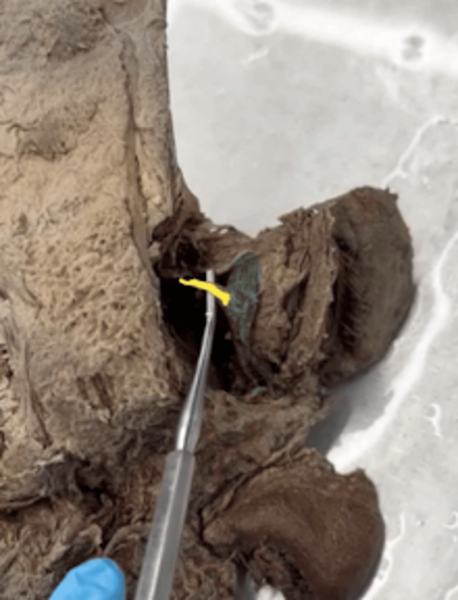 <p>Name the structure. (yellow)</p>