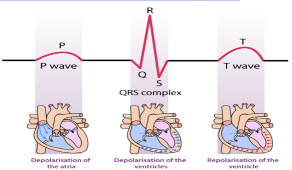<p>Electrocardiogram (ECG):</p><ul><li><p>What is it?</p></li><li><p>P Wave:</p></li><li><p>QRS Complex:</p></li><li><p>T Wave:</p></li></ul><p></p>