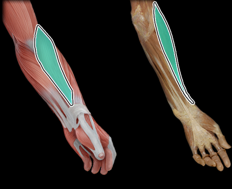 <p>A muscle of the forearm that flexes the elbow joint, particularly when the forearm is in a neutral position. It originates from the humerus and inserts at the styloid process of the radius.</p>