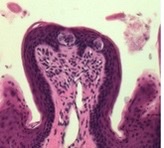 <p>what type of papillae?</p>