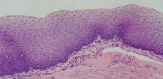 <p>Multiple layers of cells; protects against severe mechanical or chemical stresses.</p>