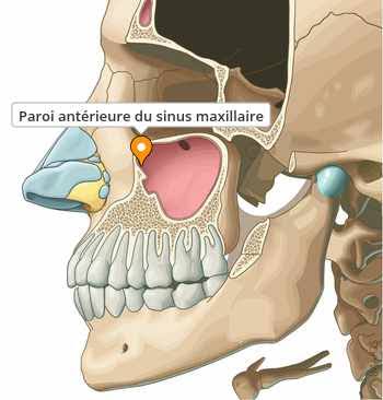 <p>Dans le maxillaire, le plus volumineux, un de chaque côté</p>