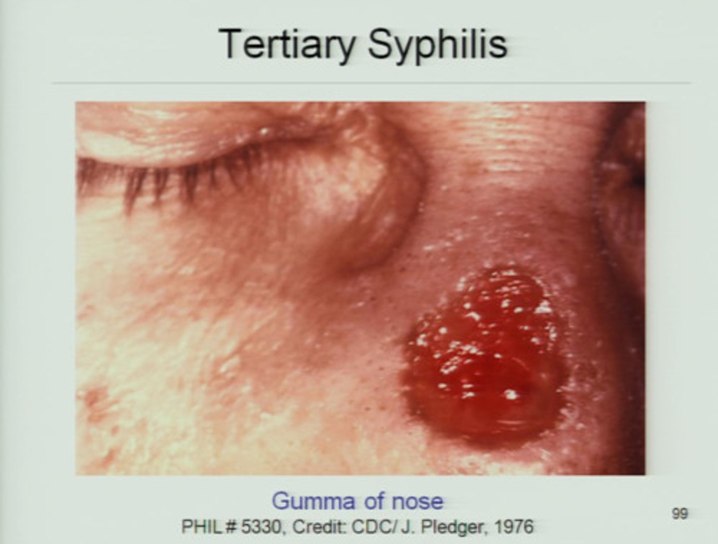 <p>also known as vascular lesions; vascular lesions involve the blood or circulatory system</p>