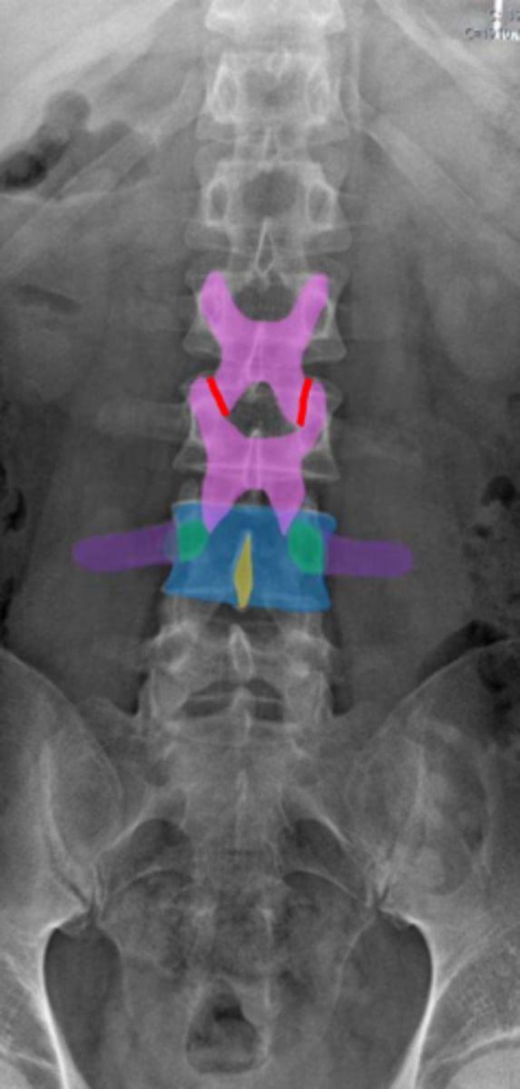 <p>What vertebrae is being examined?</p>