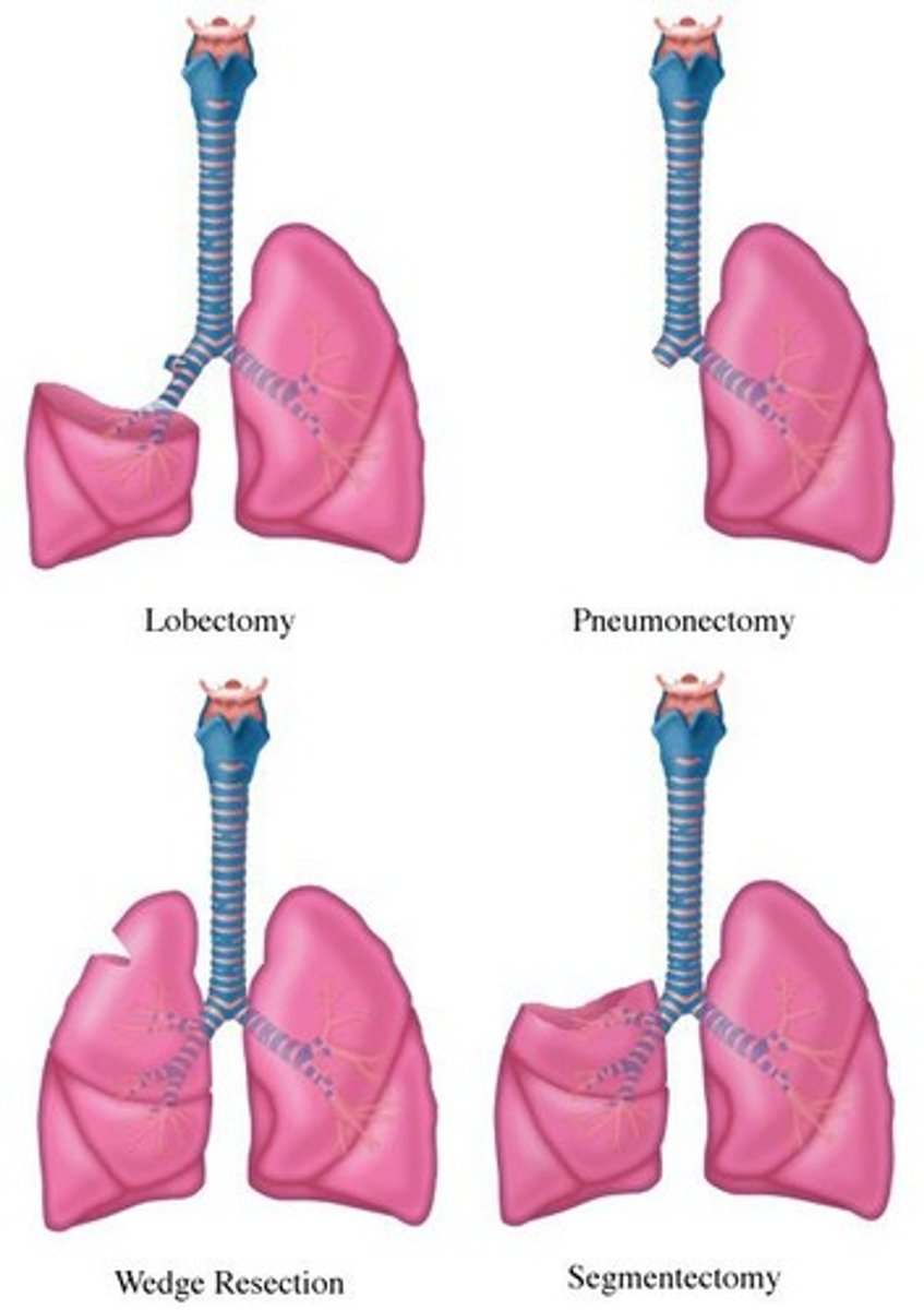 <p>Wedge resection, segmentectomy, lobectomy, bilobectomy, bronchoplastic/sleeve resection, and pneumonectomy.</p>