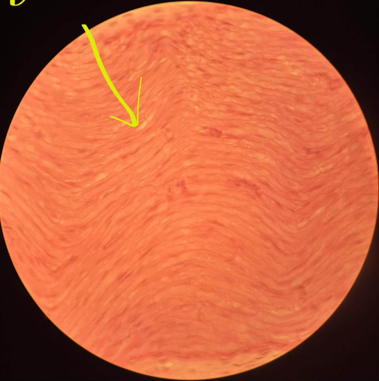 term image