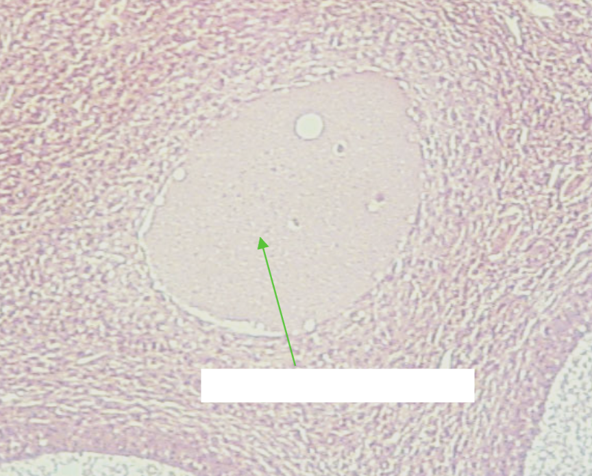 <p>What is the structure being shown in this image?</p><p>*Hint:&nbsp;With time, a hyaline intercellular material accumulates, and the former corpus luteum assumes the appearance of an<strong> irregular white, hyaline scar</strong>.</p>