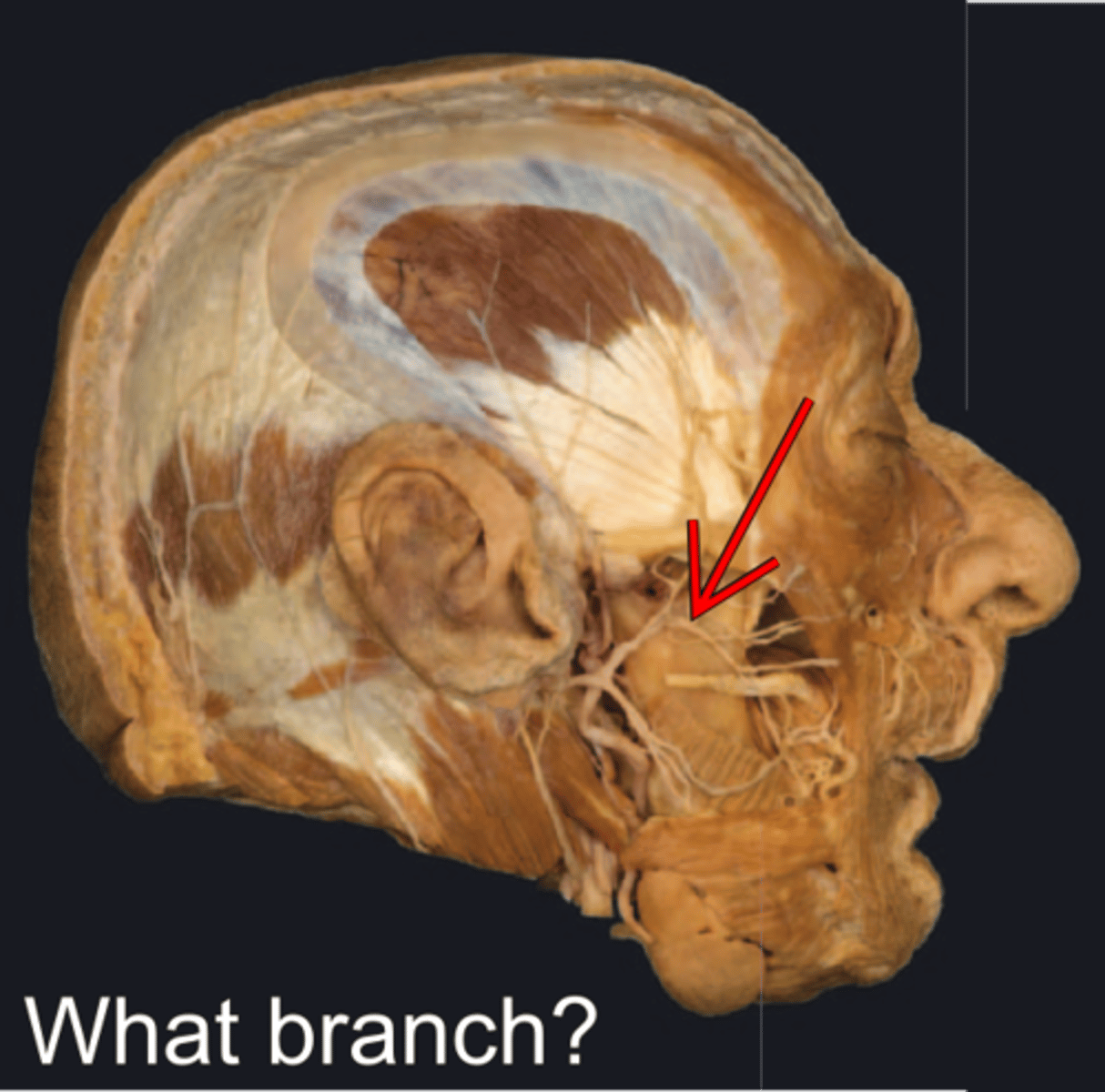 <p>What is displayed?</p>