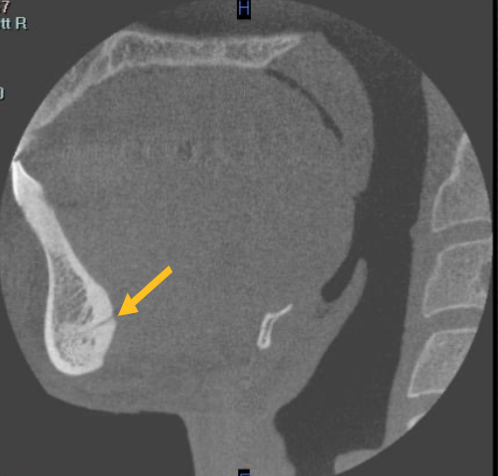 <p>identify the structure </p>