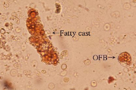 <p>lipid stain that only stains triglycerides and not cholesterol</p>