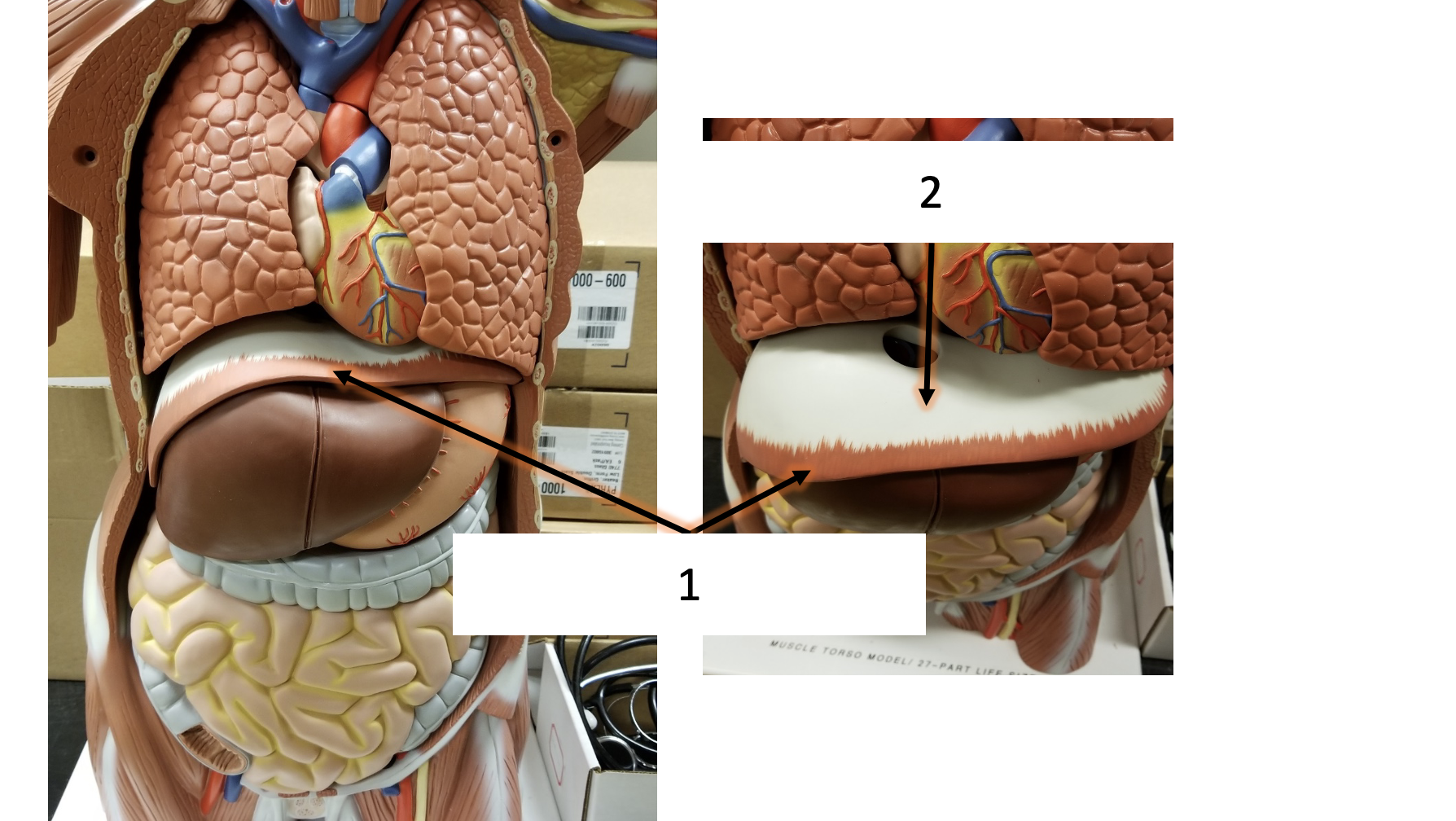 <p>name the muscle (1)</p>