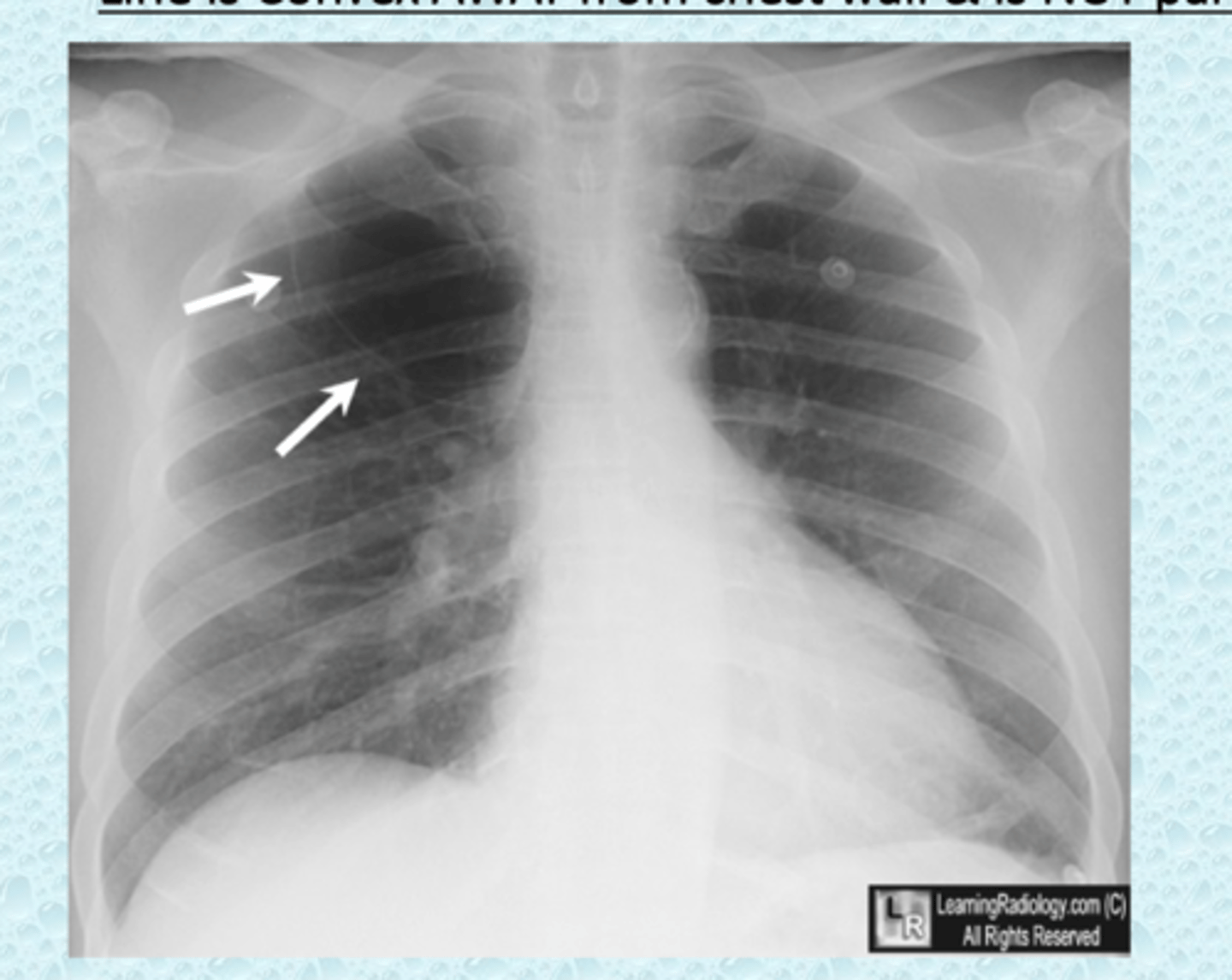 <p>what are the white arrows most likely pointing to</p>