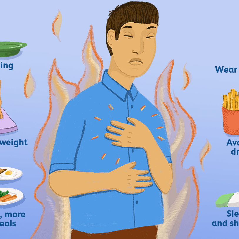 <p>Burning sensation caused by reflux or flowing back of acid from the stomach into the esophagus</p>