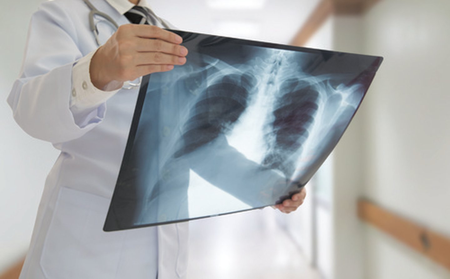 <p>X-ray</p>