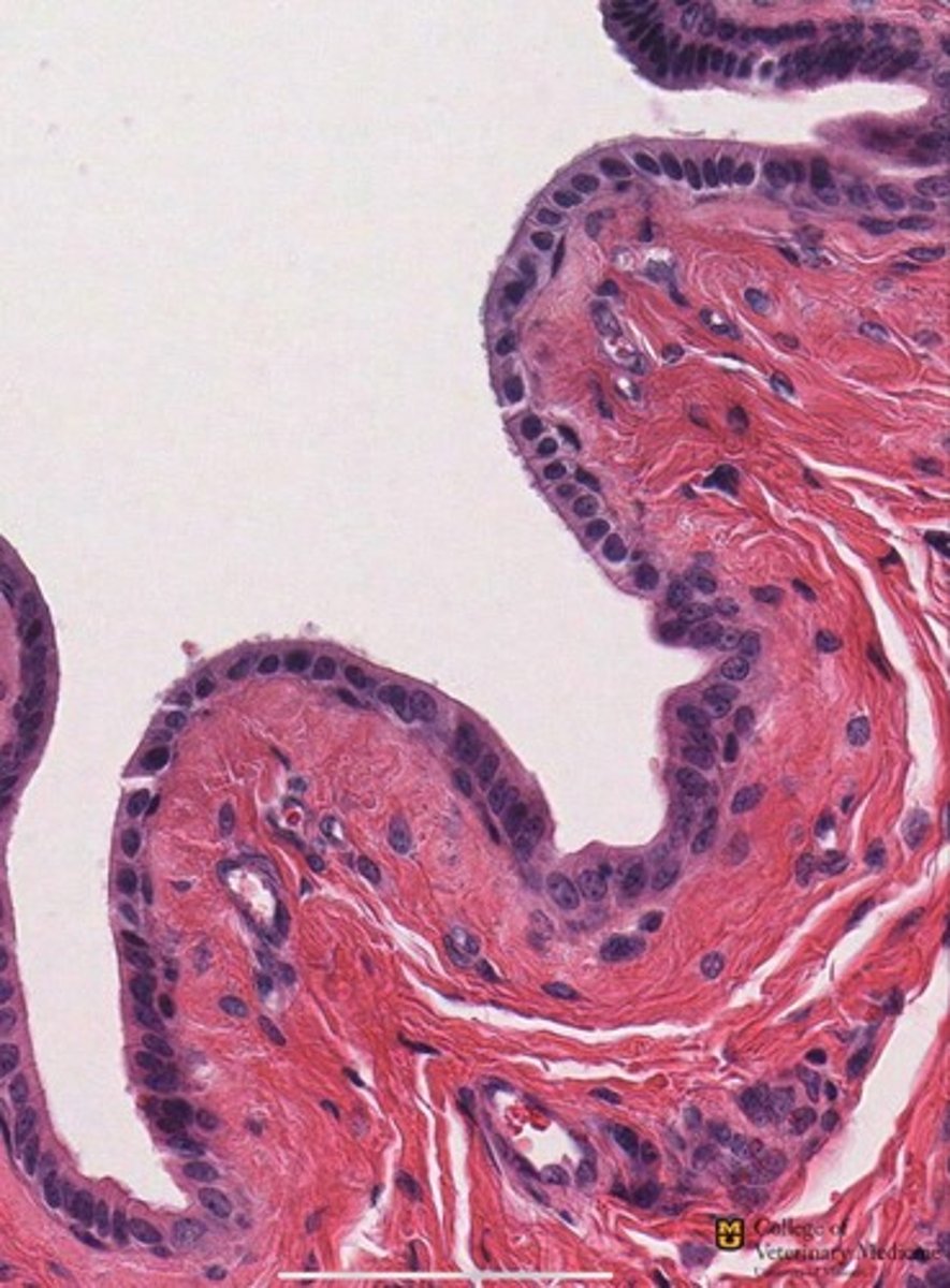 <p>What tissue type is shown?</p>