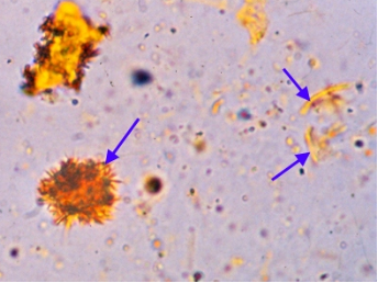 <p><span>yellow clumped needles or granule-like crystals</span></p>