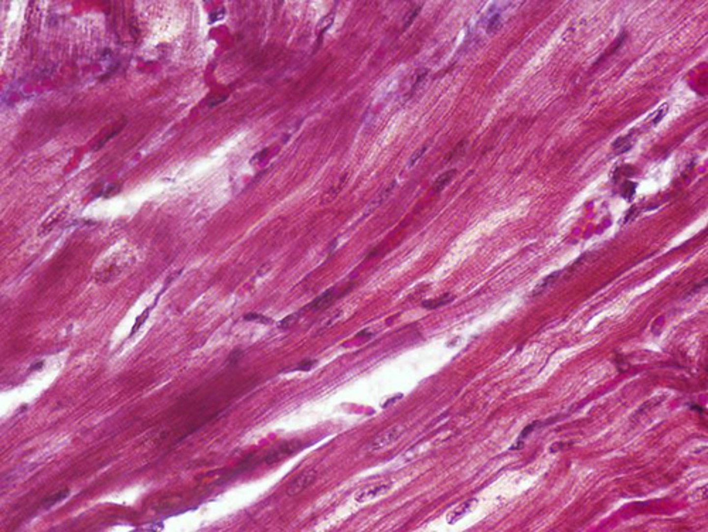 <p>Identify the type of muscle tissue shown</p>