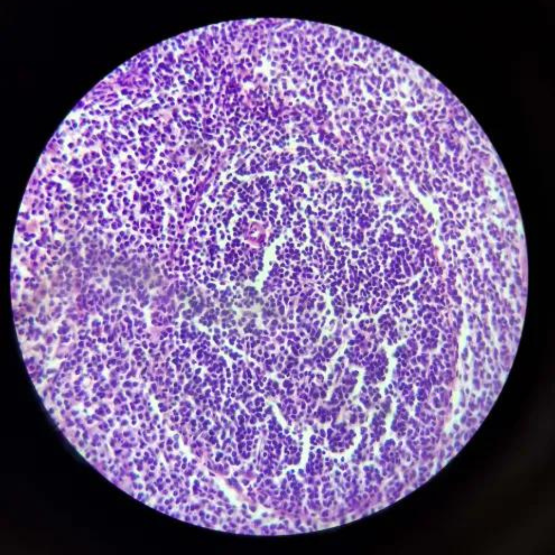 term image